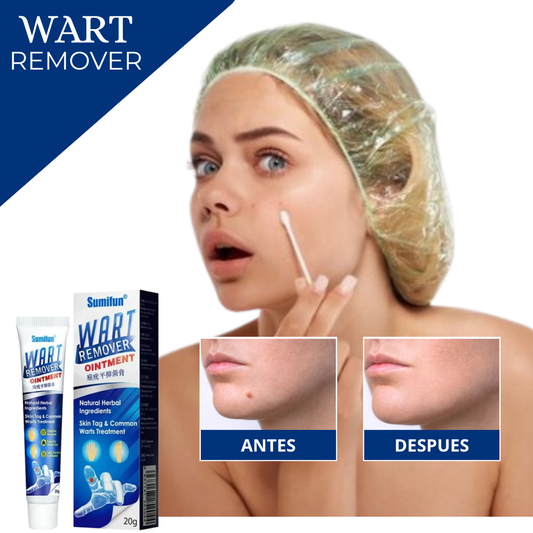 Remedio Natural para Verrugas